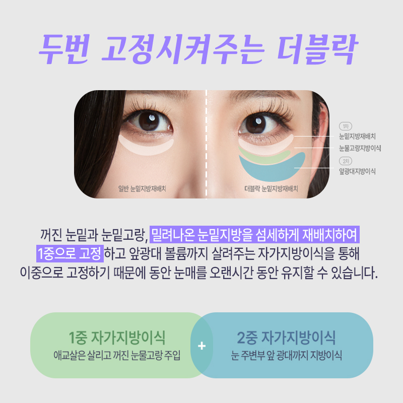 눈밑지방없애는법 김형진베이직에서는 관련 이미지 2