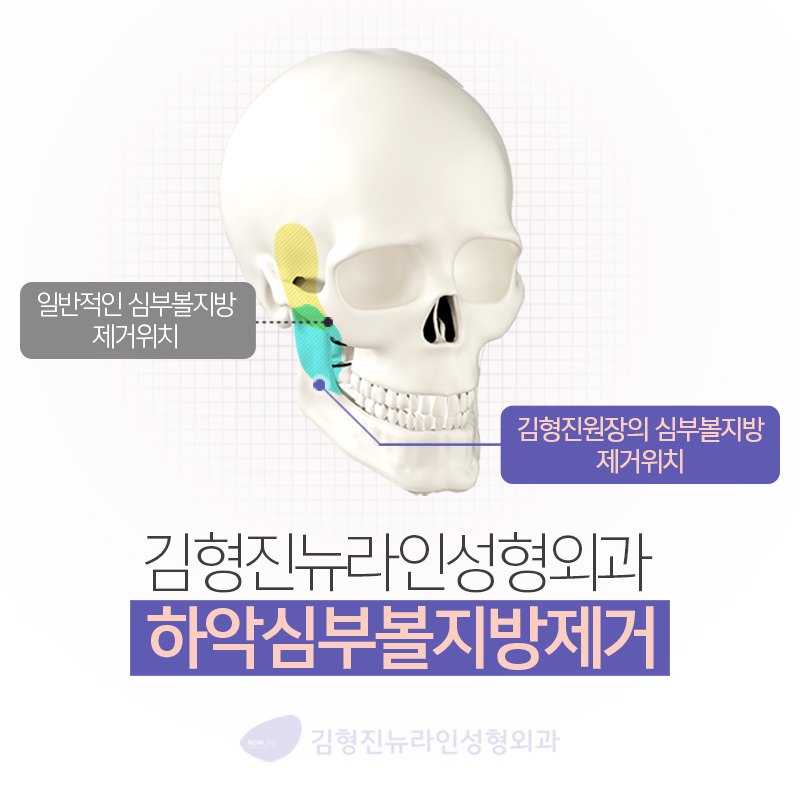 심부볼잘하는곳 이거레알 반박불가 관련 이미지 3