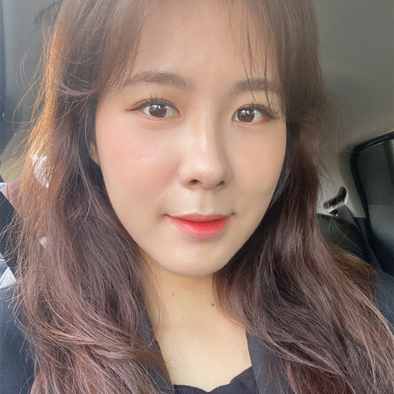 눈밑지방재배치유지력 오래 가는 곳? 당연히 김형진베이직이죠 관련 이미지 6