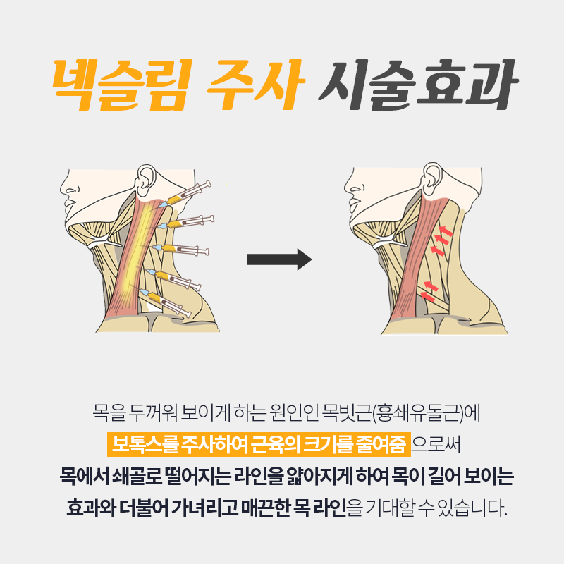 두꺼운목 해결은 넥슬림주사로 관련 이미지 4