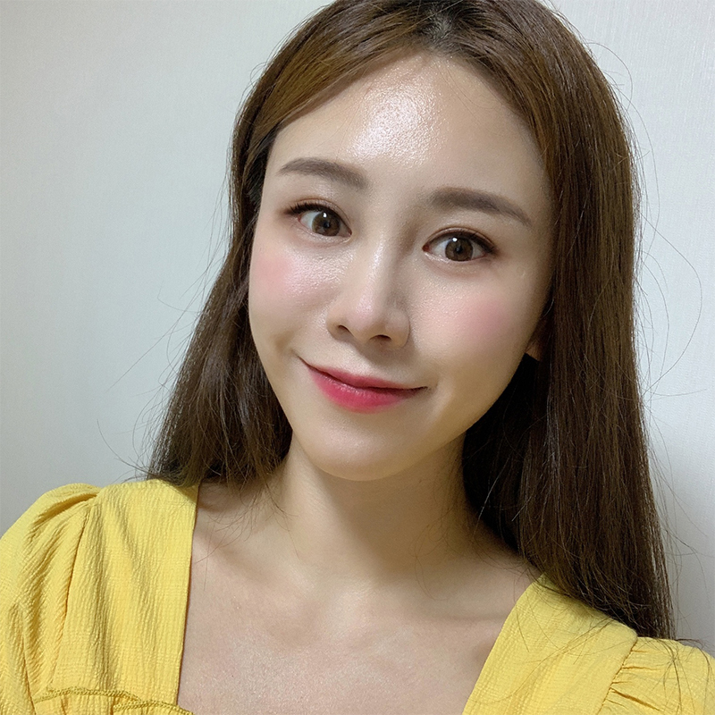 눈밑재수술 필요없는 김형진베이직 관련 이미지 6