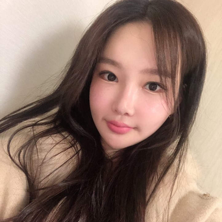 탄력까지 잡는 이중턱제거수술로 자신감 되찾았어요 관련 이미지 2