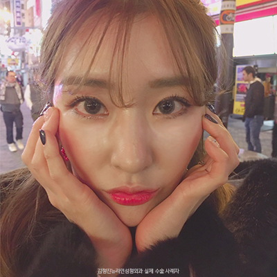 늘어진볼살 제거하는법이 궁금해? 관련 이미지 1