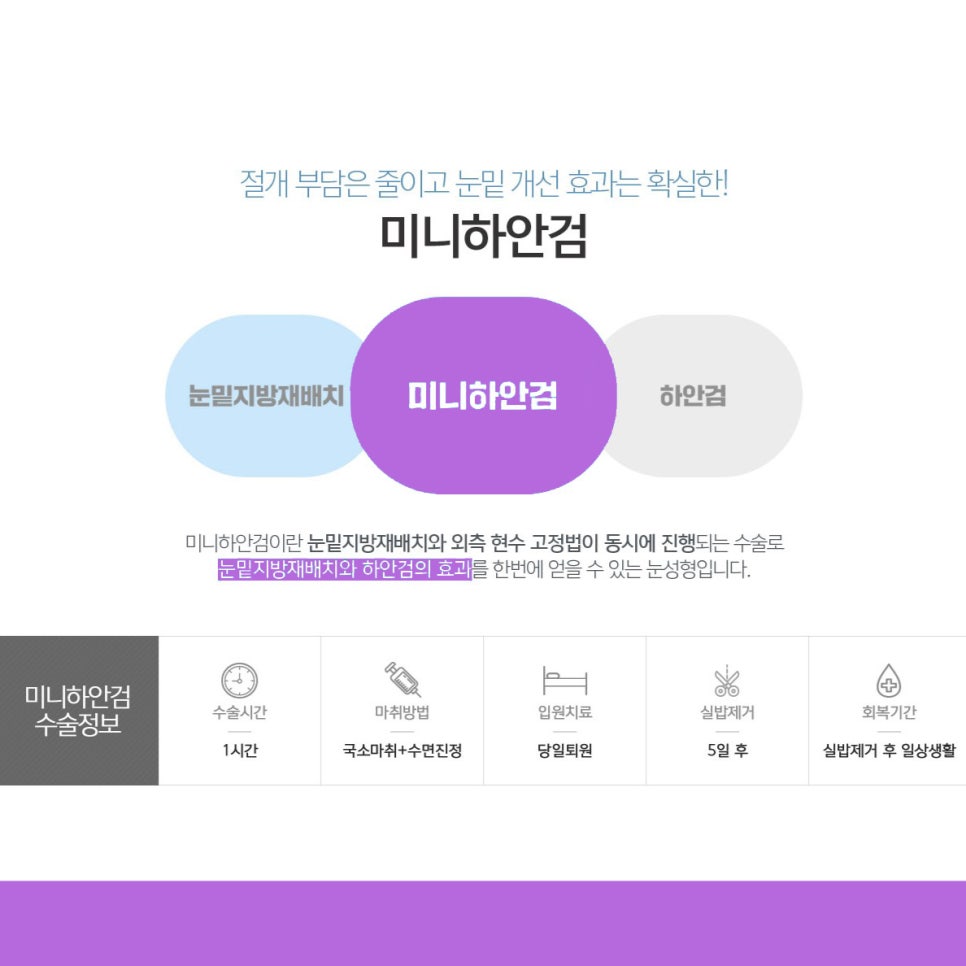 미니하안검병원 자연스럽게 잘해주는곳 찾고있다면 관련 이미지 3