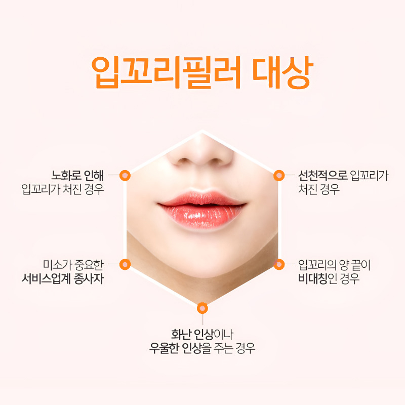 입꼬리필러 후회 돼요... 왜 이제야 했는지 관련 이미지 5