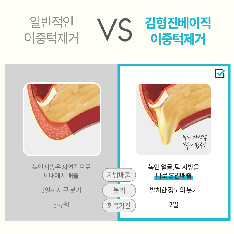 이중턱제거 너무 스트레스 받는다면 관련 이미지 5