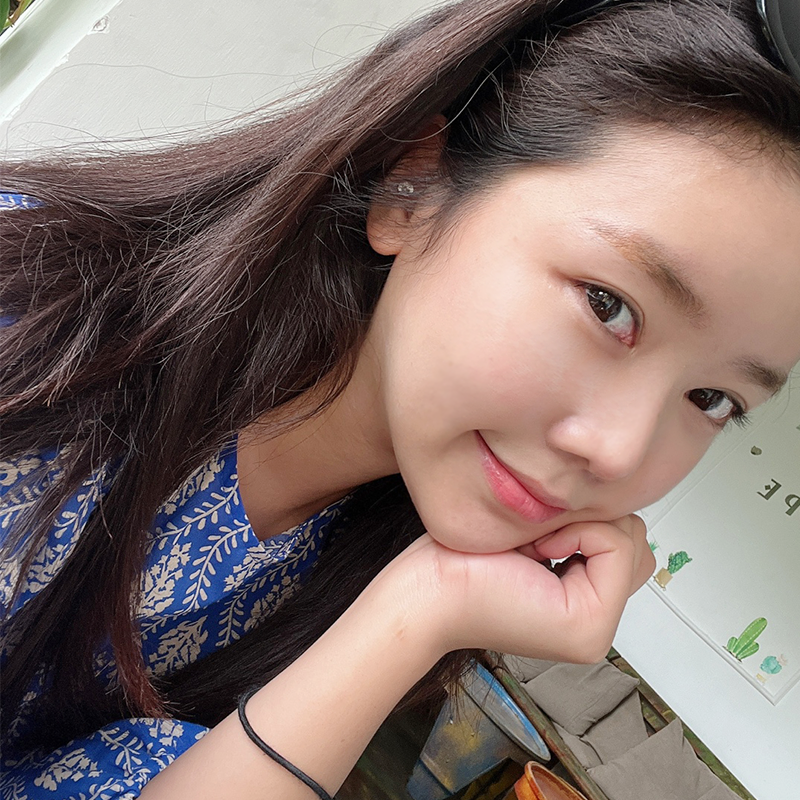 눈밑지방재배치전후 확인하고 가세요~! 관련 이미지 1