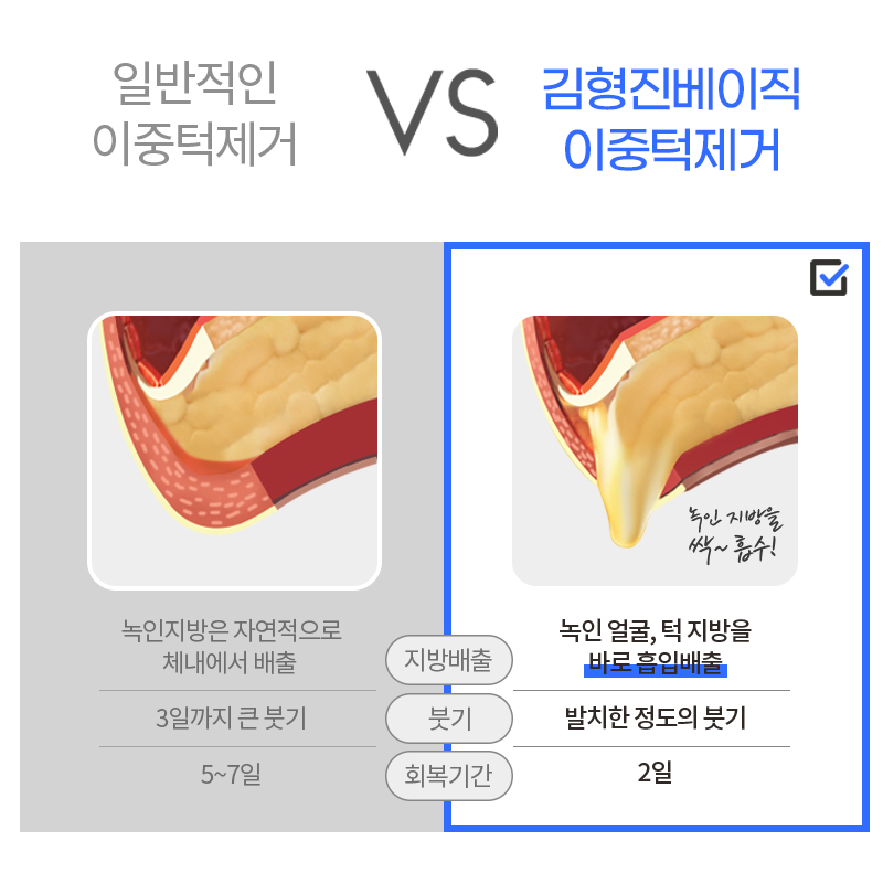 얼굴지흡으로 티 안나게 작아진 얼굴 완성! 관련 이미지 6