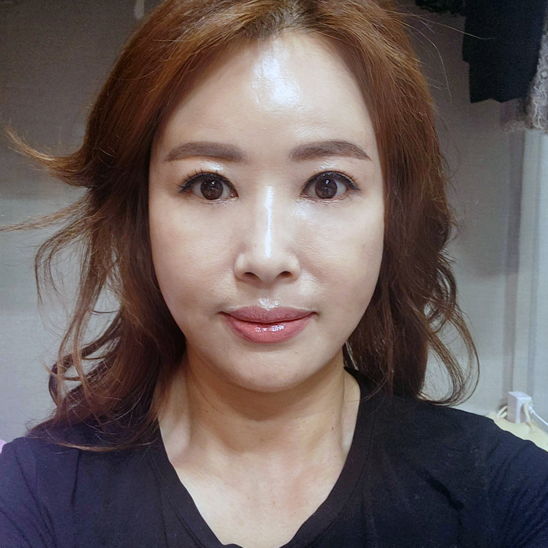 중년눈수술전후 잘하는 병원 알아보는 중이라면 관련 이미지 2
