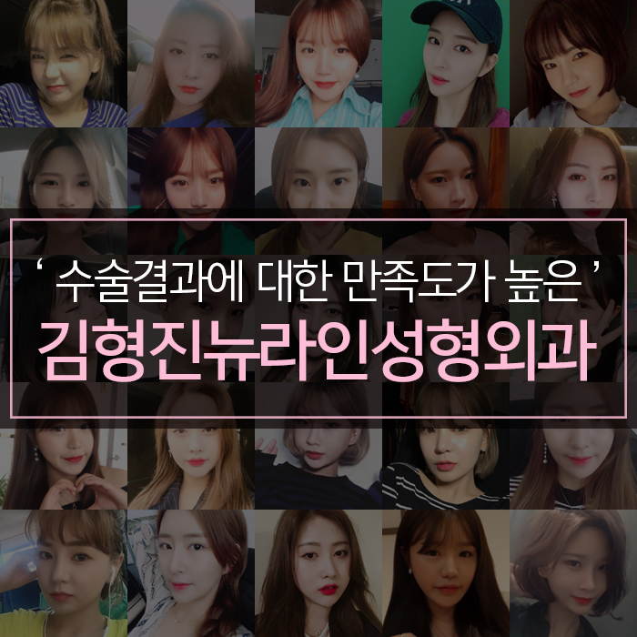 심부볼지방제거성형외과 김형진뉴라인, 알죠? 관련 이미지 9