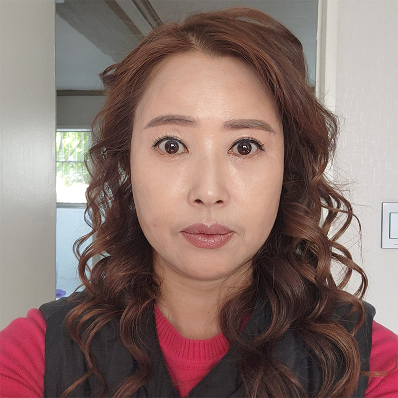 중년눈밑수술 더 이상 미루지 마세요! 관련 이미지 1