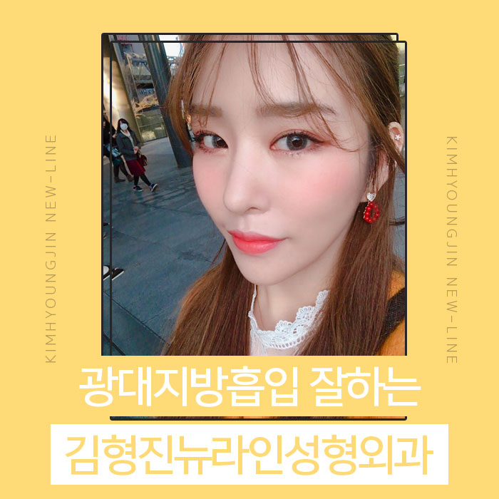 광대지방흡입 김형진뉴라인성형외과지 관련 이미지 1