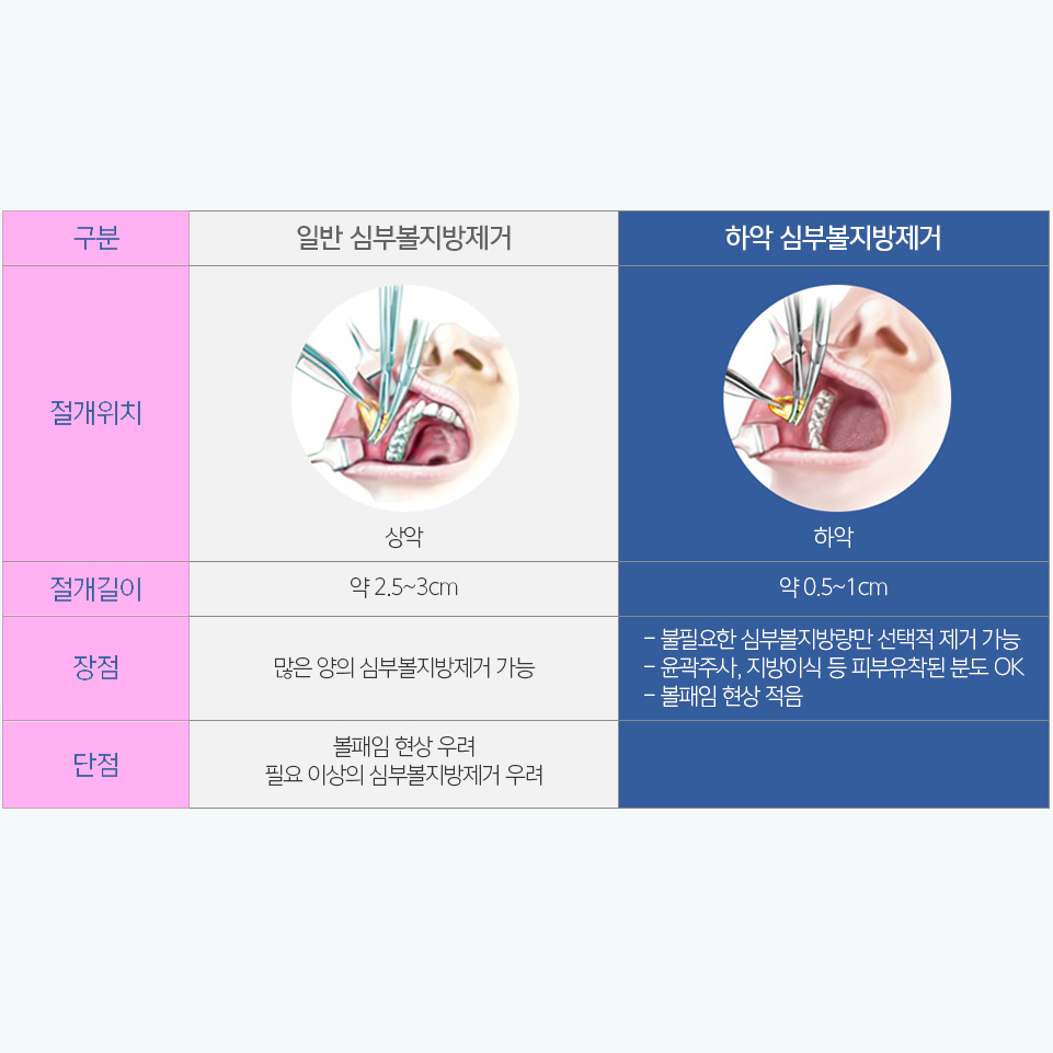 I Found the Way to Get Rid of the Deep Cheek Fat That Was Stressing Me Out! image 5