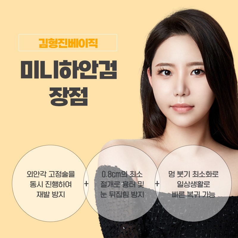 중년미니하안검으로 눈 밑 고민 해결했어요! 관련 이미지 4