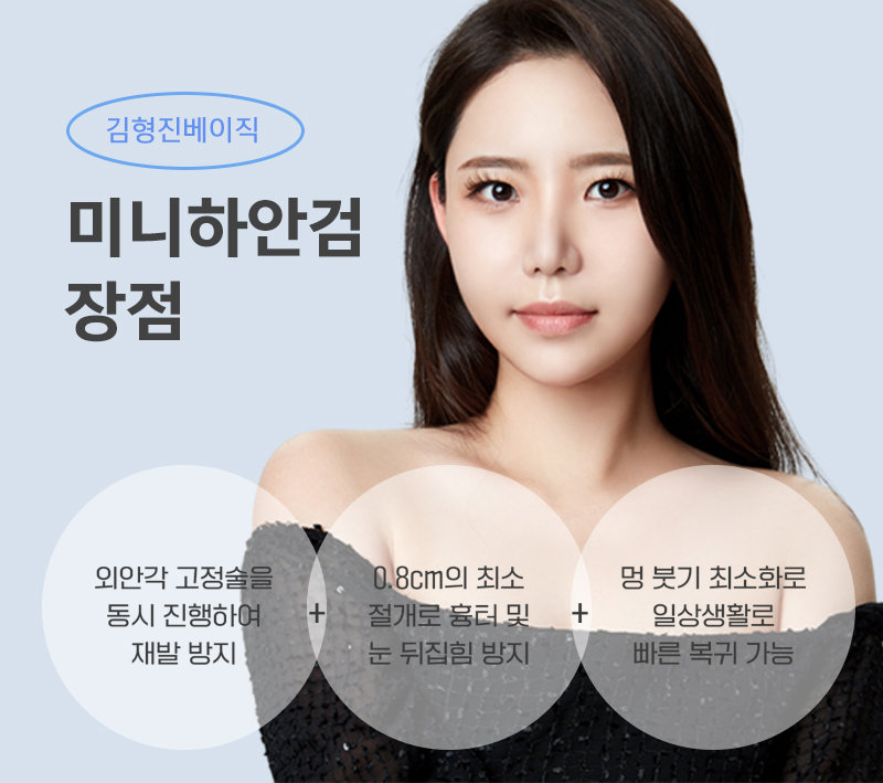미니하안검붓기 걱정하지마세요! 관련 이미지 2
