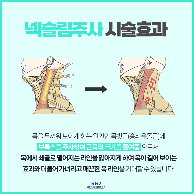 넥슬림주사효과 원조는 다르네요... 관련 이미지 4