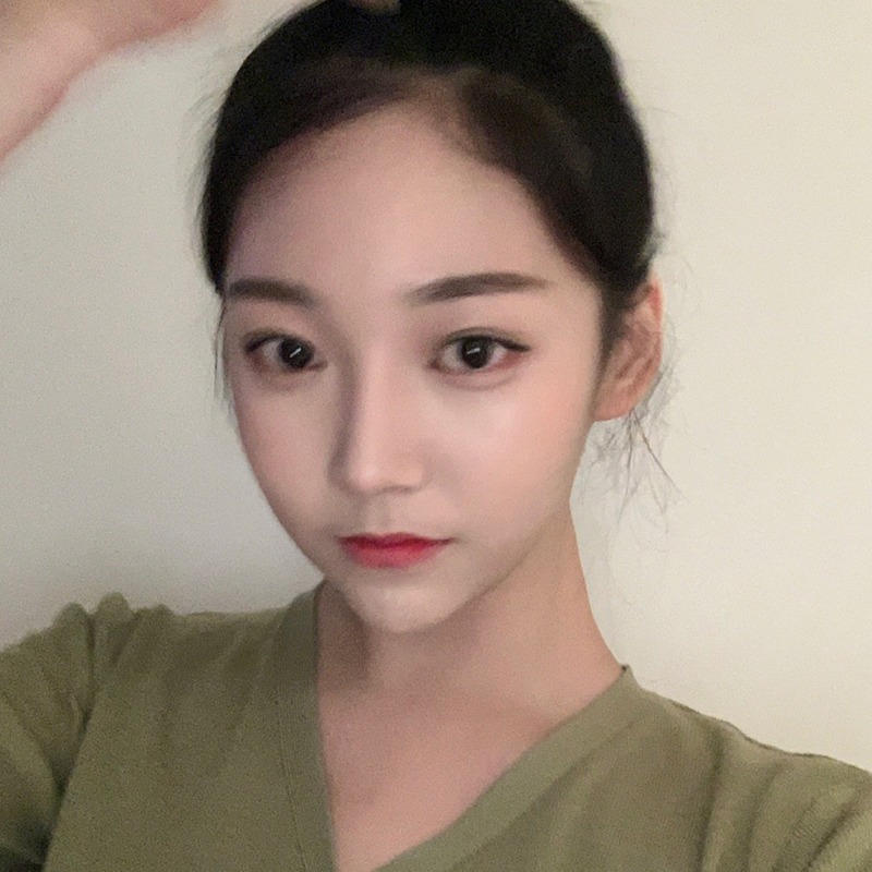 눈밑재수술 필요없는 김형진베이직 관련 이미지 4