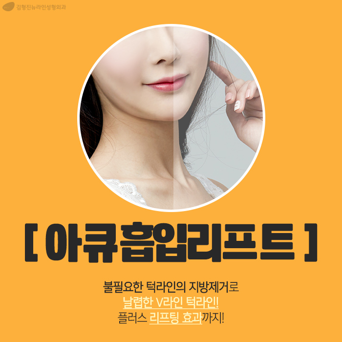 이중턱지방흡입후기 솔직하게 관련 이미지 4