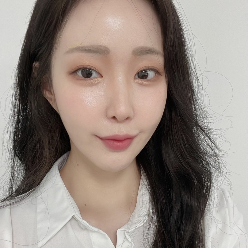 만족도 높은 입꼬리필러시술 여기에요 여기! 관련 이미지 4