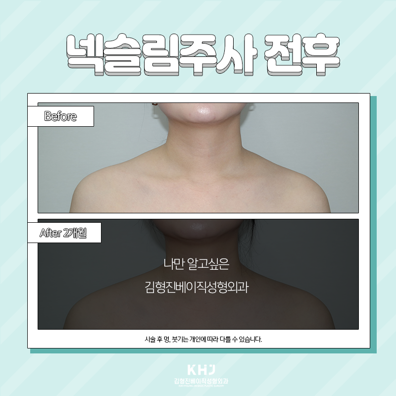 목얇아지는법 궁금하셨다면? 관련 이미지 4