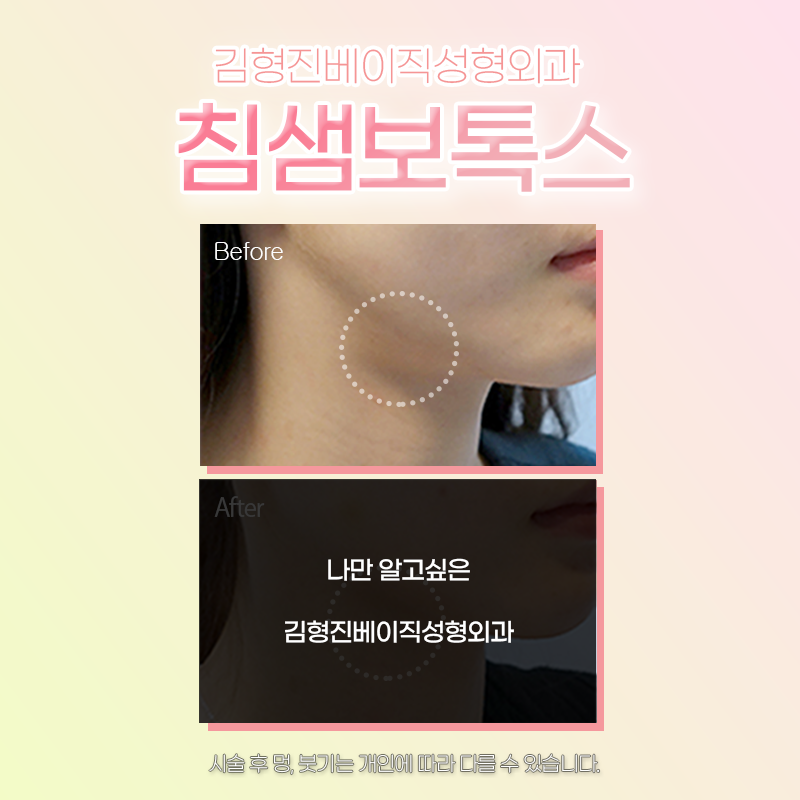 침샘비대증치료 김형진베이직에서 하셔야죠! 관련 이미지 5