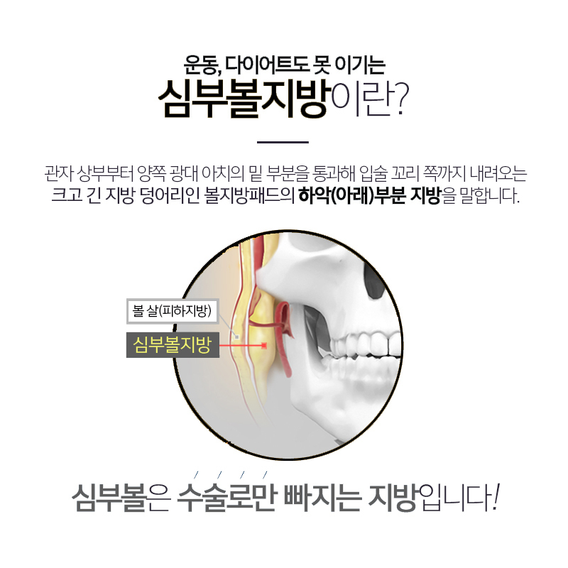 강남얼굴지방흡입은 무조건 김형진베이직이라고 하는 이유 관련 이미지 5