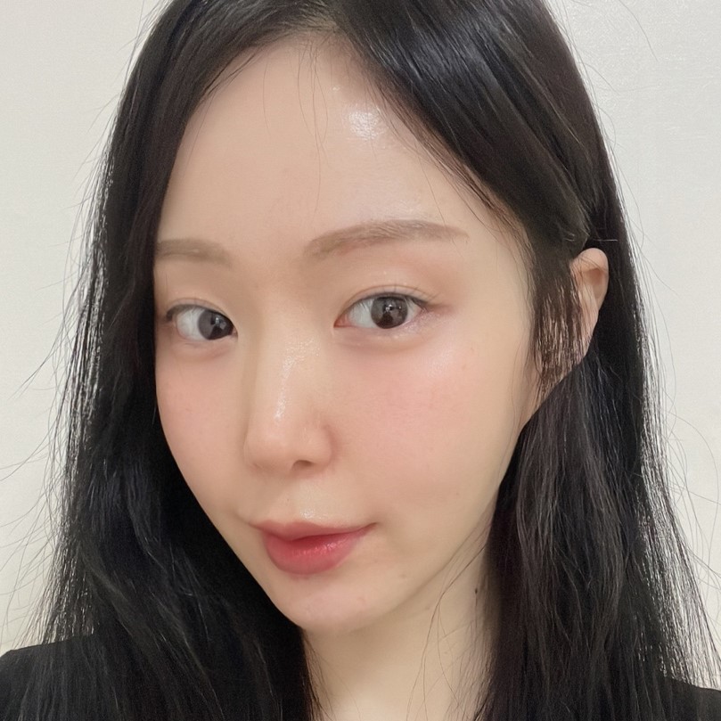 얼굴지방흡입잘하는곳에서 갸름한 얼굴 완성했어요 관련 이미지 3