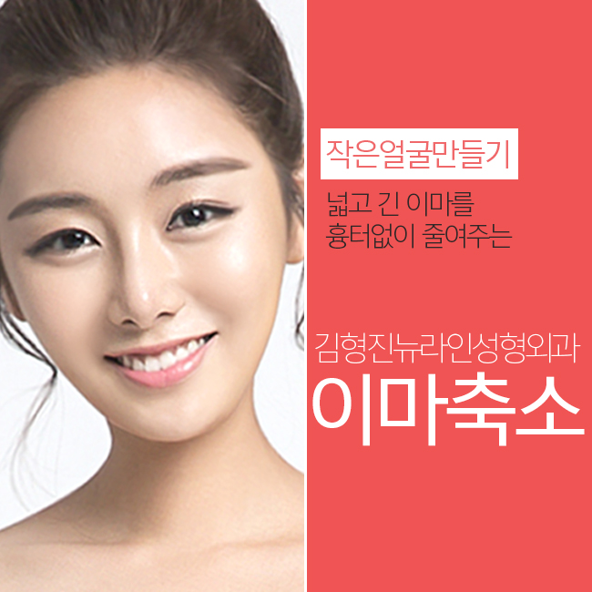이마축소수술로 넓고 긴 이마를 작은얼굴로! 관련 이미지 1