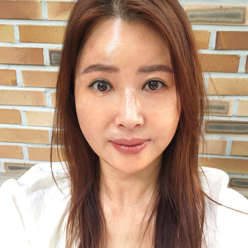 중년성형후기, 눈 밑이 조금만 달라져도 인상이 확 바뀌어요! 관련 이미지 2