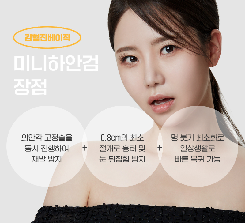 요즘 중년눈밑처짐수술 만족도 1위로 등극한 미니하안검?! 관련 이미지 4