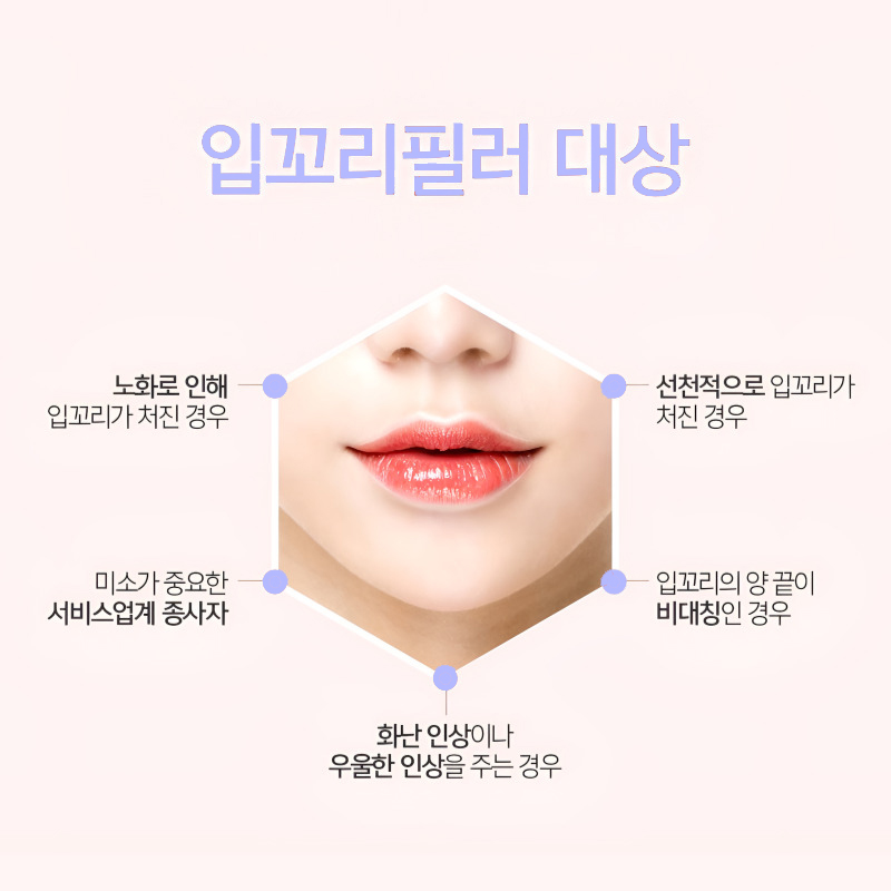입꼬리필러잘하는곳에서 입꼬리부터 인상까지 밝게! 관련 이미지 6