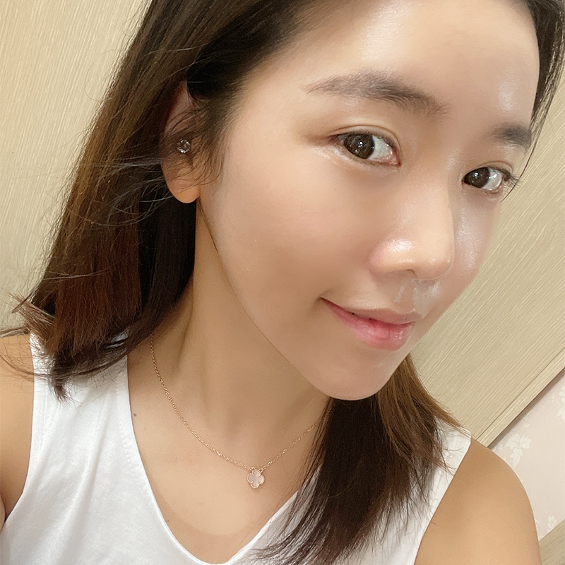 침샘보톡스유지기간 궁금하셨죠? 관련 이미지 4