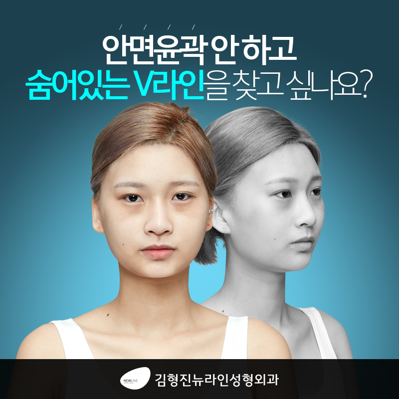 비수술안면윤곽 이거 완전 그뤠잇! 관련 이미지 1