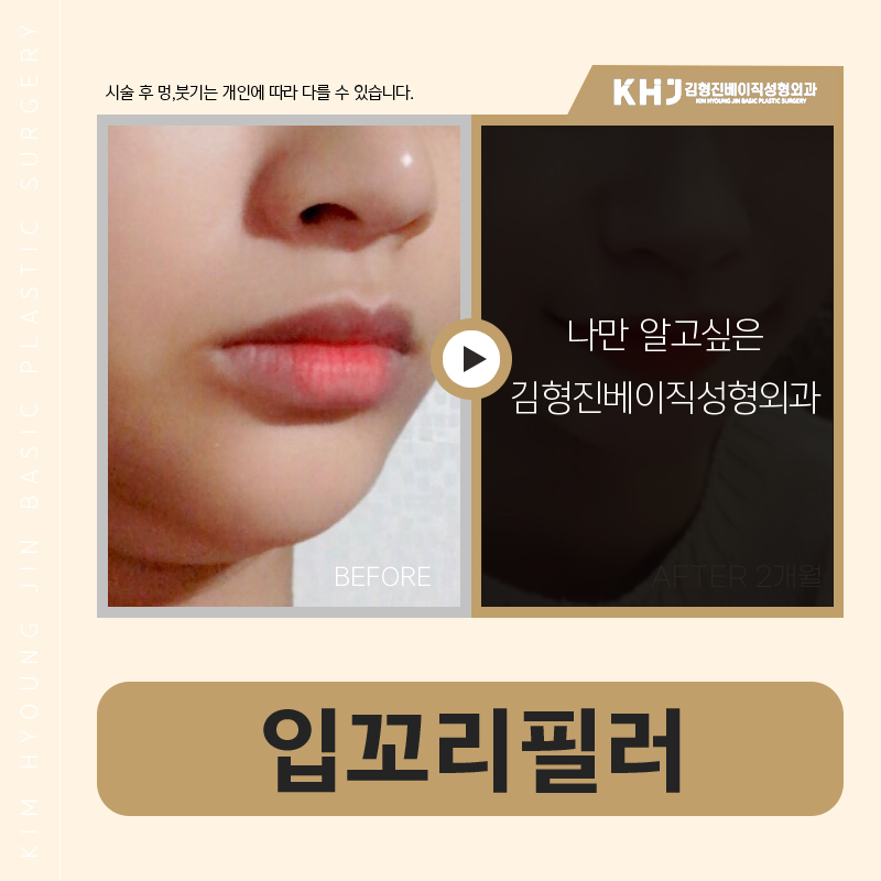 환하게 웃는 인상, 입꼬리올리는방법으로 완성해요! 관련 이미지 5