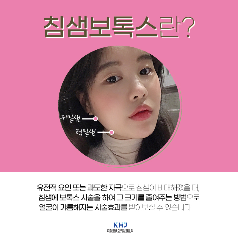 침샘보톡스추천 하면 김형진베이직 관련 이미지 3
