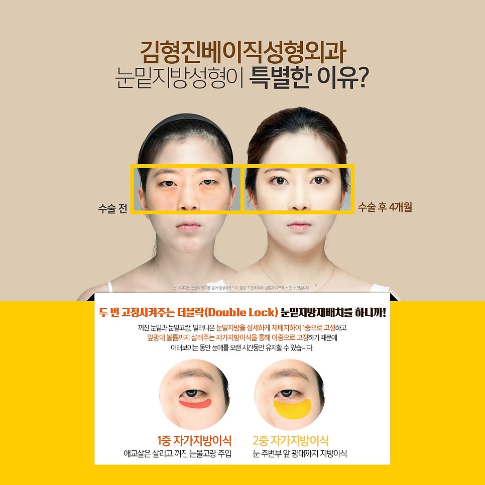 눈밑지효과 제대로 볼 수 있는 곳에서 해야죠 관련 이미지 4