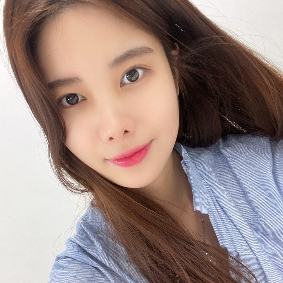 The Hidden Facial Contours Revealed Through Facial Liposuction image 2