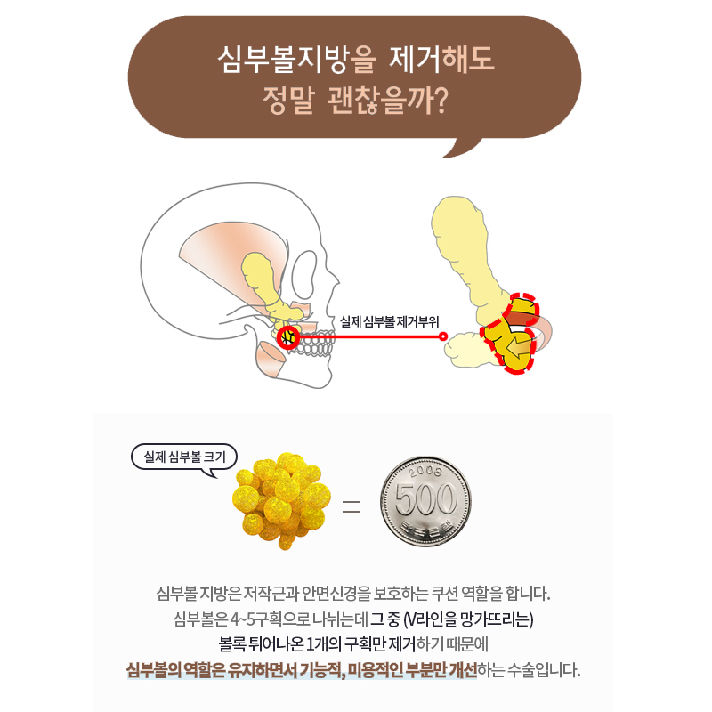 압구정심부볼제거 심술보 같은 불독살이 고민이라면? 관련 이미지 5