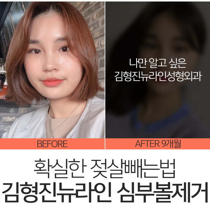 젖살빼는법 따로 있어요 관련 이미지 3