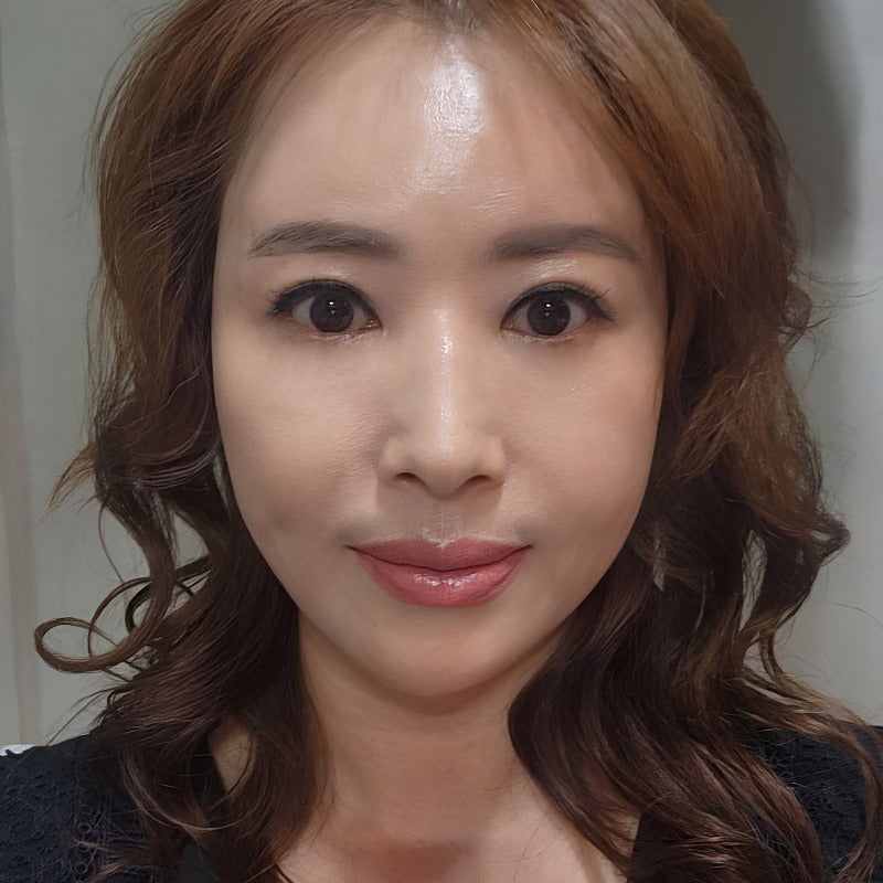 눈밑처짐수술로 나이 들어 보이는 노안 이미지 탈출했어요! 관련 이미지 1