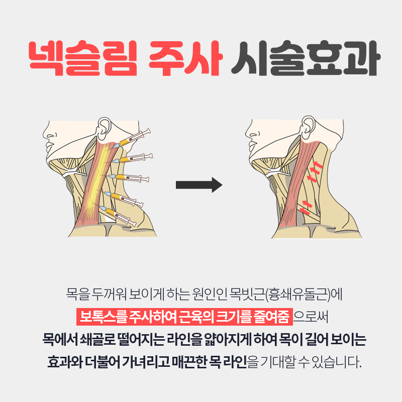 예비신부관리 시작해보자구요! 관련 이미지 4