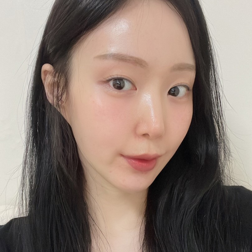 입꼬리에 진심인 김형진베이직의 리얼한 입꼬리필러후기 관련 이미지 2