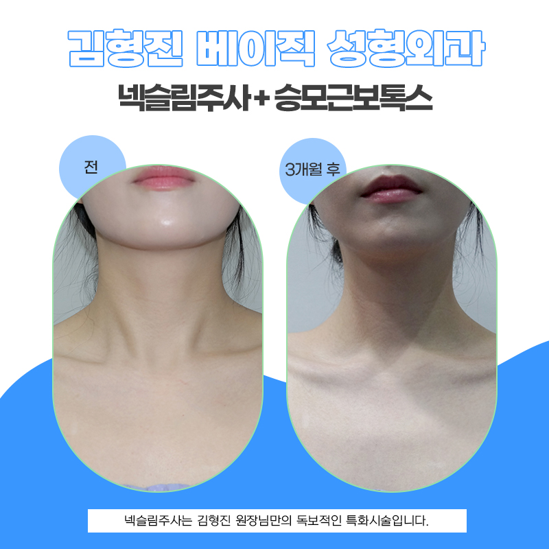 슬림한 넥라인 만들어주는 목얇아지는방법 관련 이미지 5