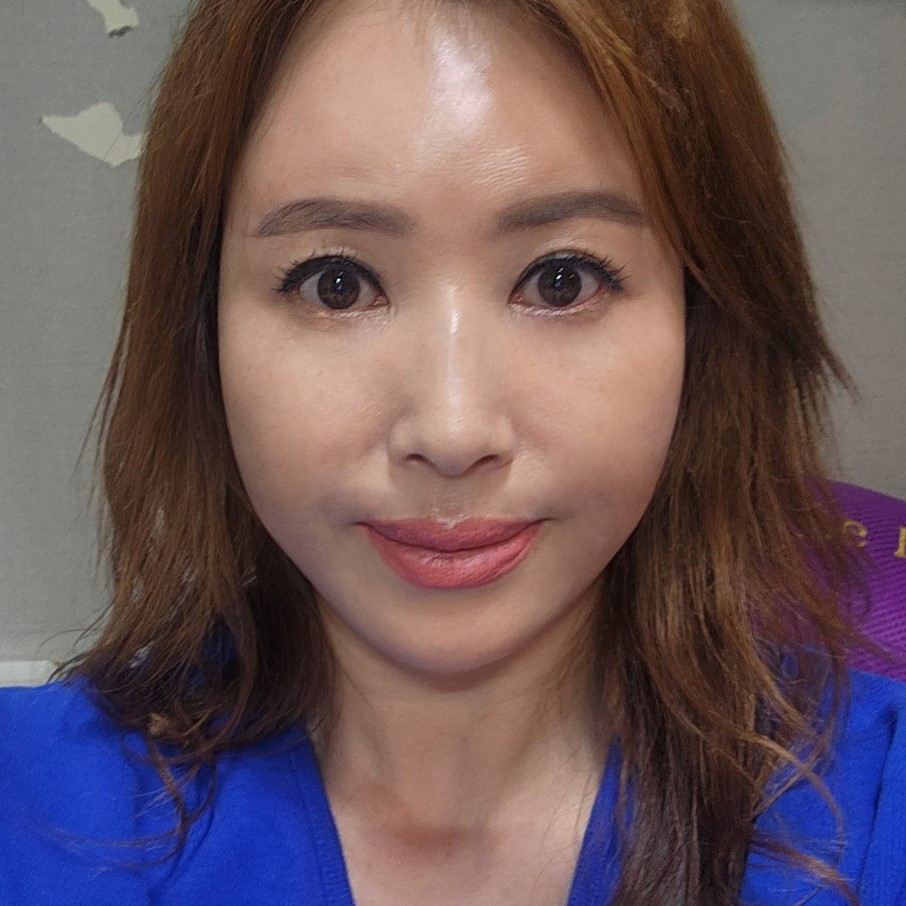 눈밑처짐수술 고민해결하고 동안소리 들어요 관련 이미지 2