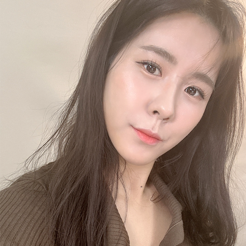 눈밑지방재배치전후 보고 가세요! 관련 이미지 1