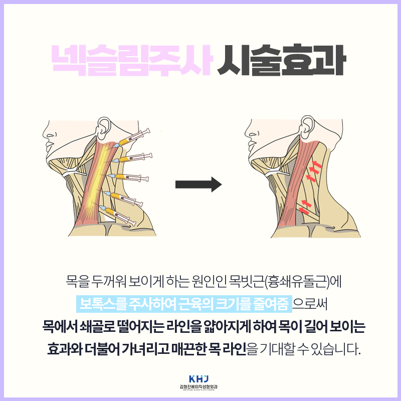 원조는 넥슬림주사전후 부터 다르네요 관련 이미지 4