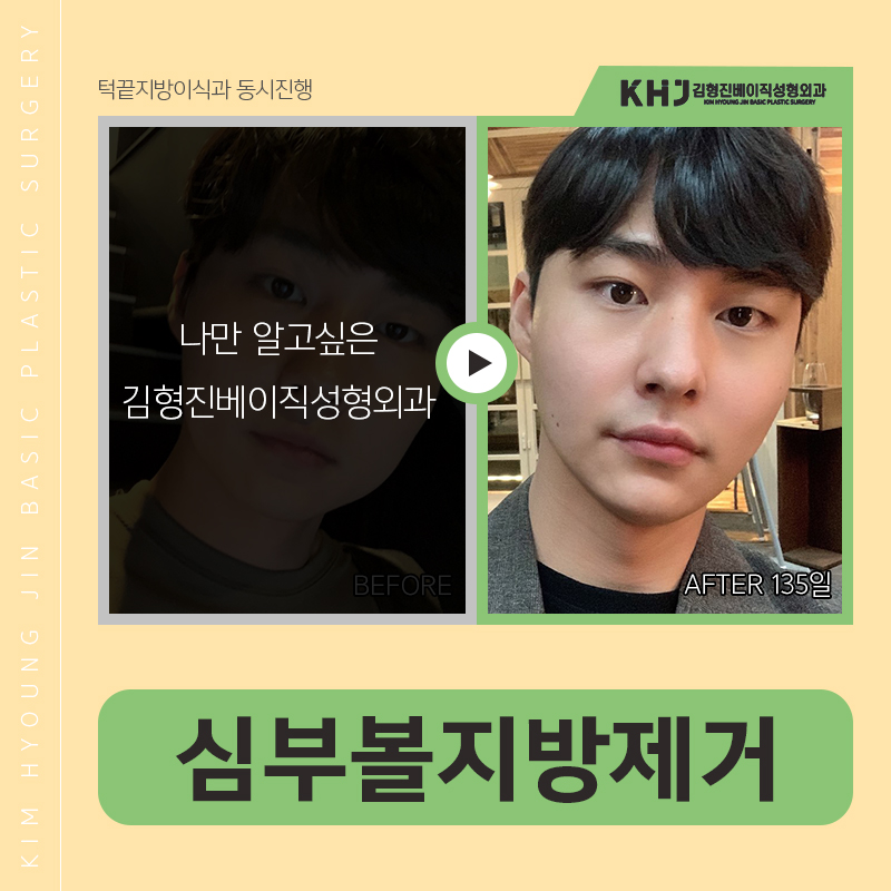 심부볼위치 어딘지 궁금하셨다구요? 관련 이미지 4