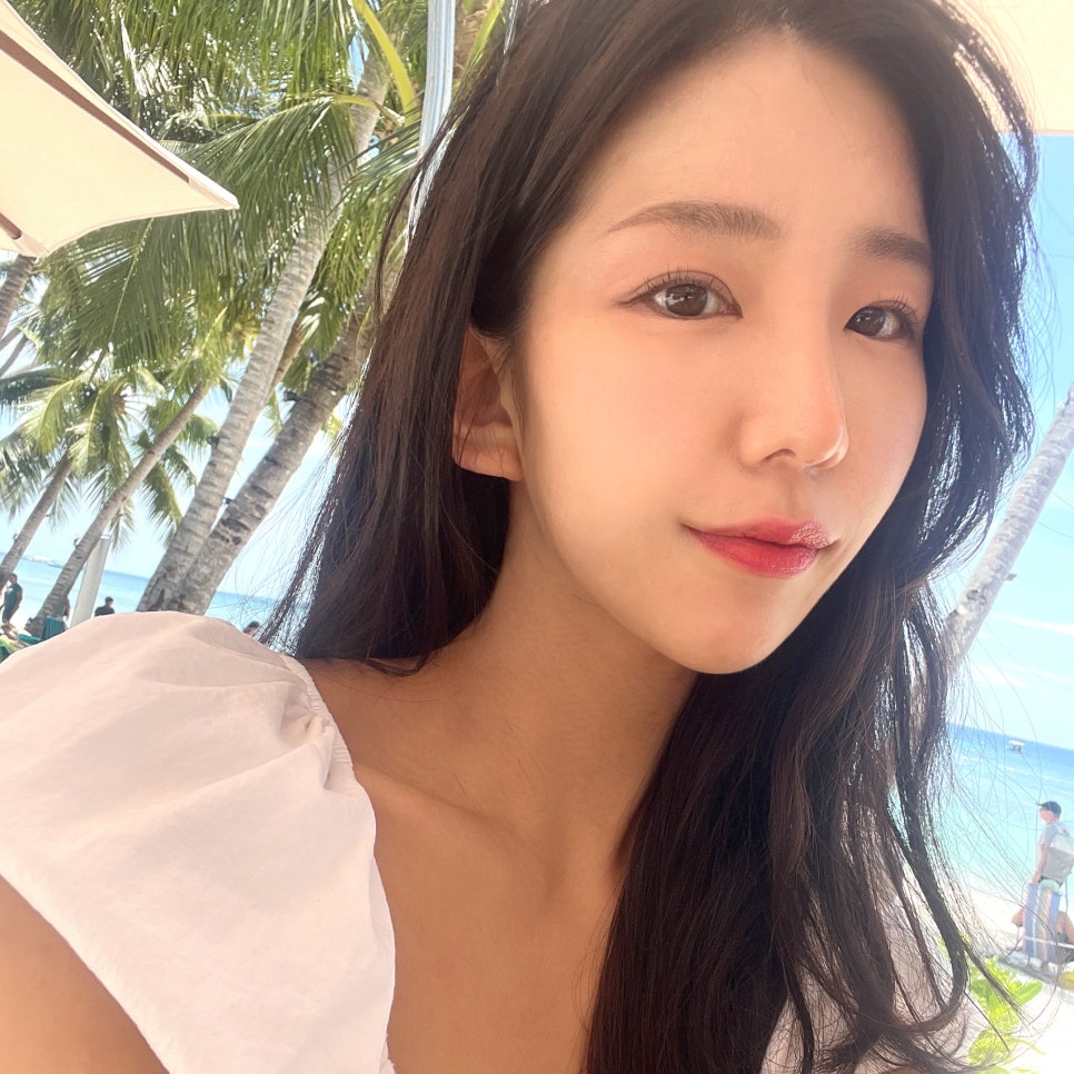 입꼬리필러잘하는곳에서 입꼬리부터 인상까지 밝게! 관련 이미지 3