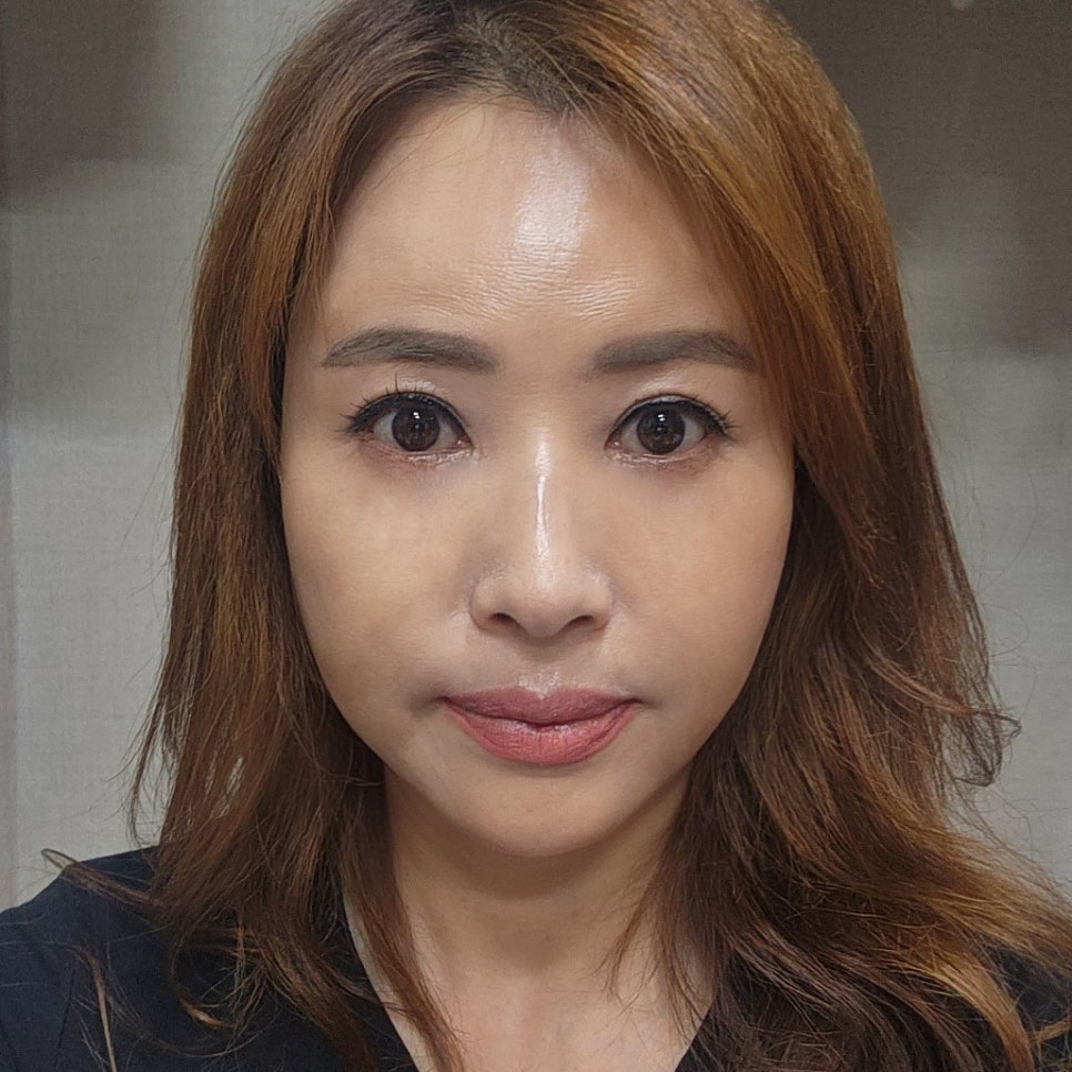 중년눈밑처짐 해결방법 찾고 계셨다면 관련 이미지 1