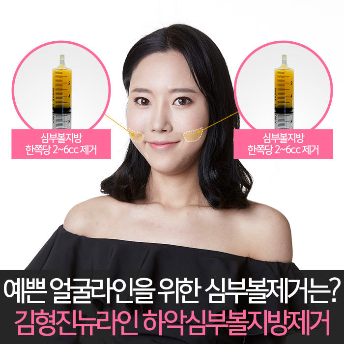 땅콩형얼굴 고민만 하고 있나요? 관련 이미지 5